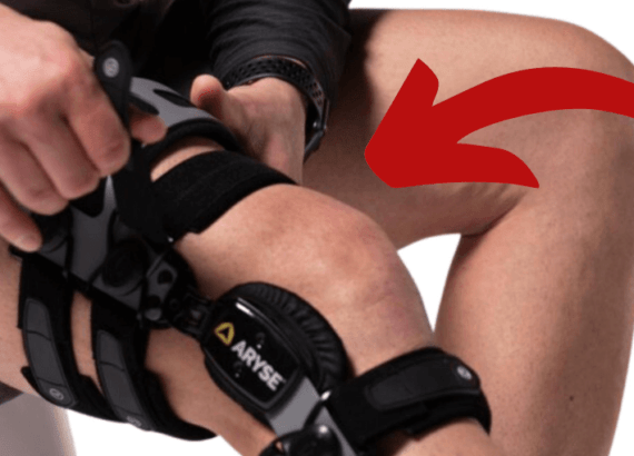 HOW LONG TO WEAR A KNEE BRACE FOR A TORN MENISCUS (1)